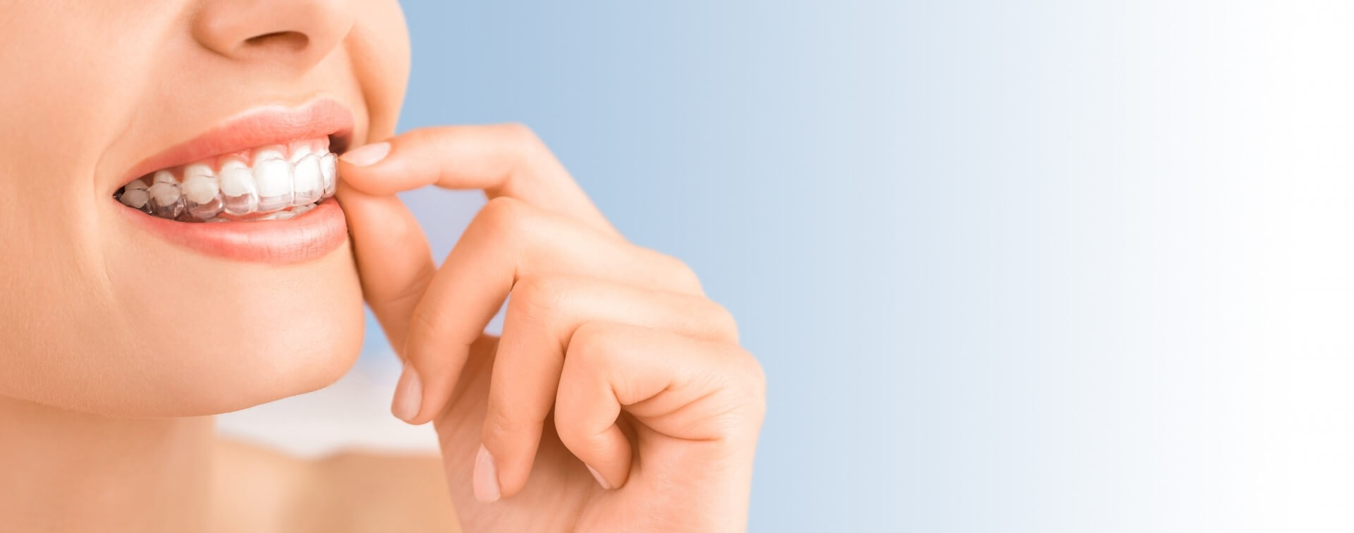 Ocean Orthodontic Clinic You Smile We Smile